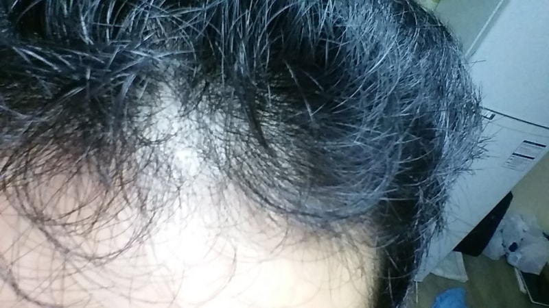 20160714_090327.jpg