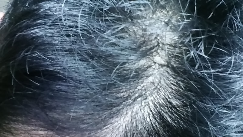 20160714_090210.jpg