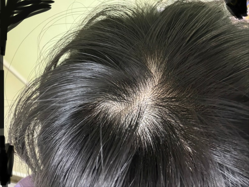 안녕하세요 약 복용후 복용전 상태입니다 
