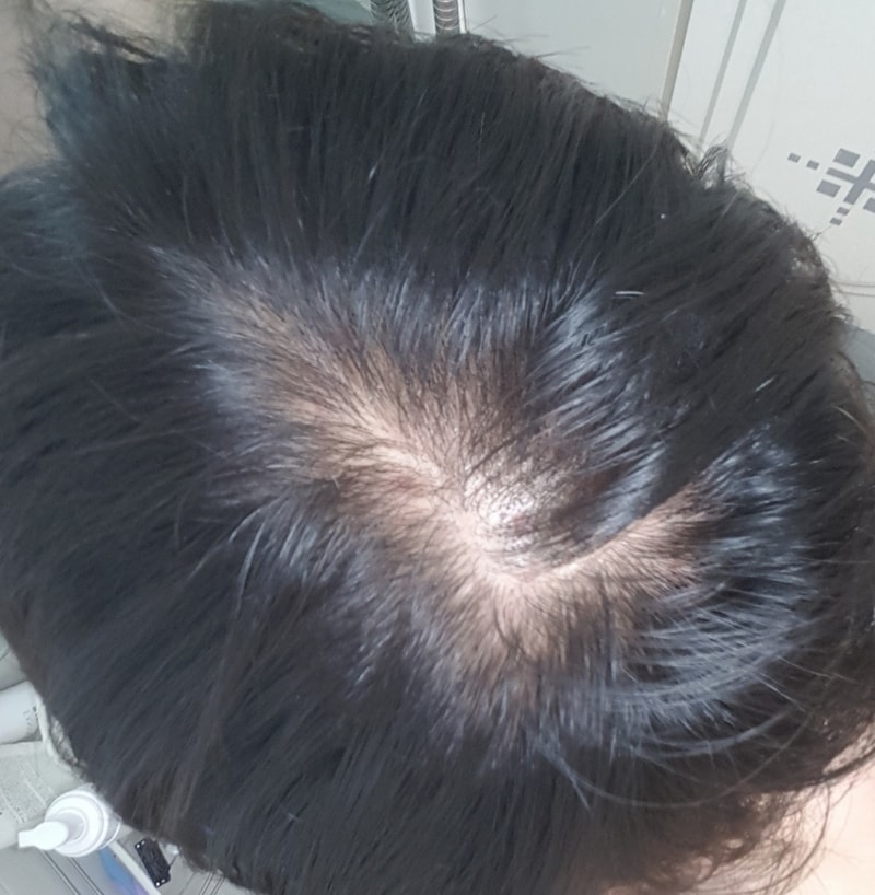 너무아파요.jpg