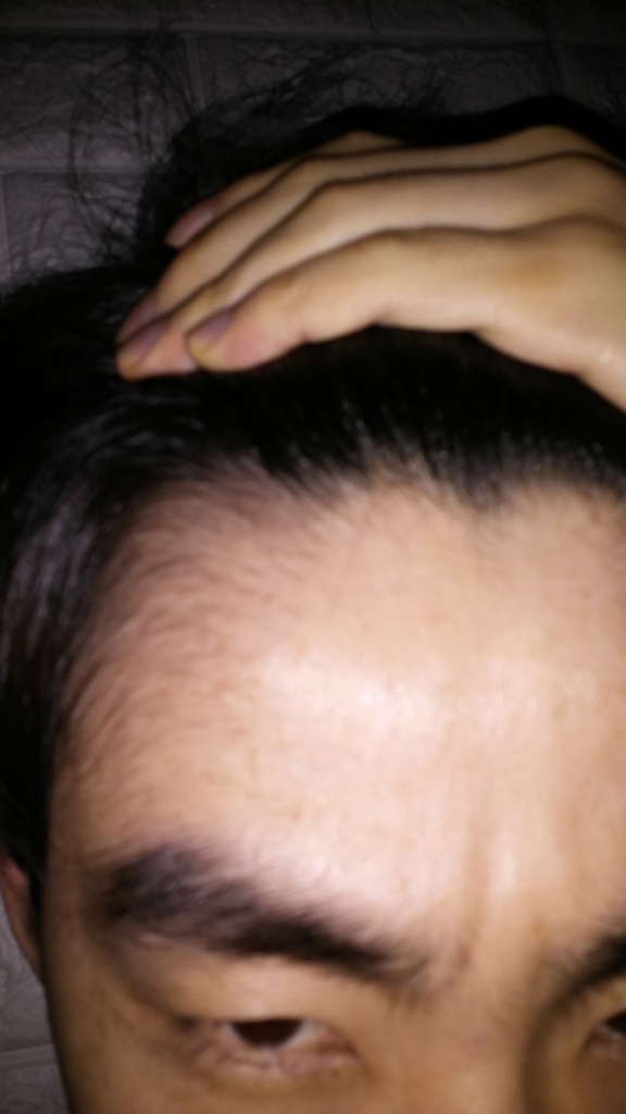 20170127_164755.jpg