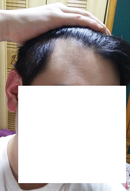 20170918_191029.jpg