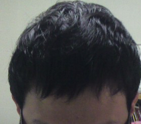 후.jpg