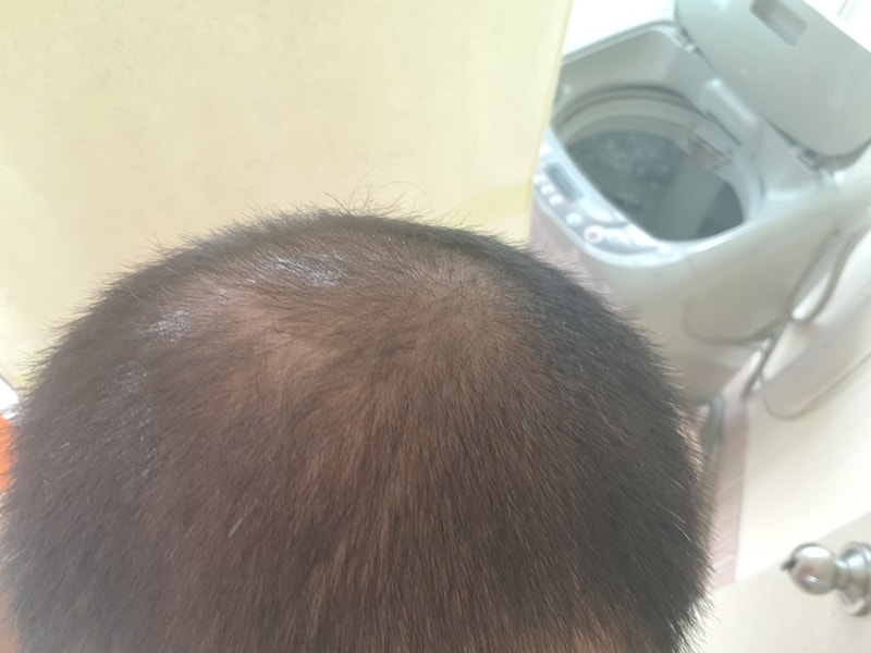 20180702_152949.jpg