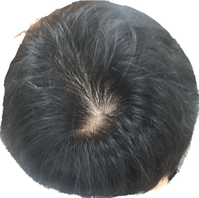 20170921_233703.png