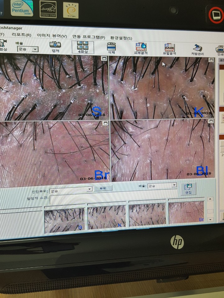 KakaoTalk_20180306_221937488.jpg