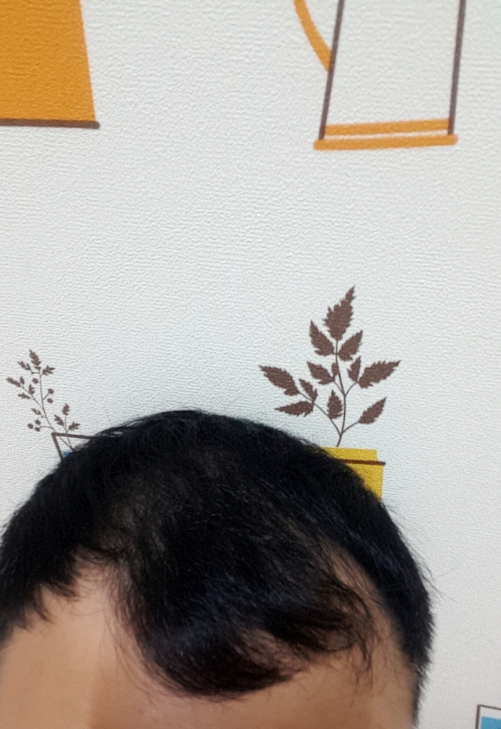 20170914_231528.jpg