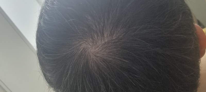 20250624_081635.jpg