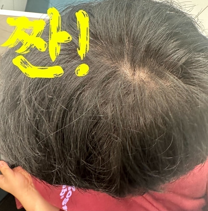 저 비오틴 영양제 다 분석해봄 후.jpg