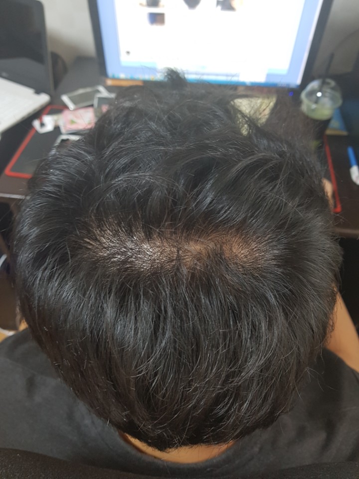 [크기변환]KakaoTalk_20180902_172342500.jpg