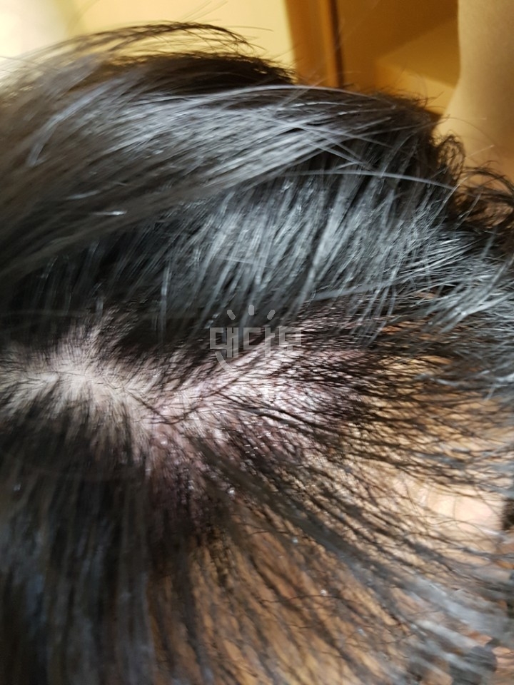 크기변환_KakaoTalk_20170927_222638873.jpg