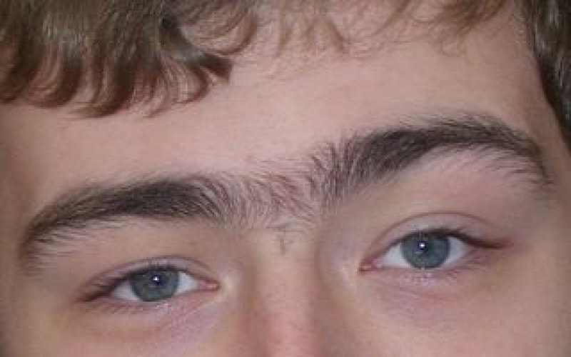 320px-Unibrow.jpg