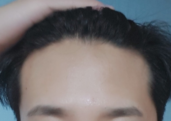 Screenshot_20180806-234758_Gallery.jpg