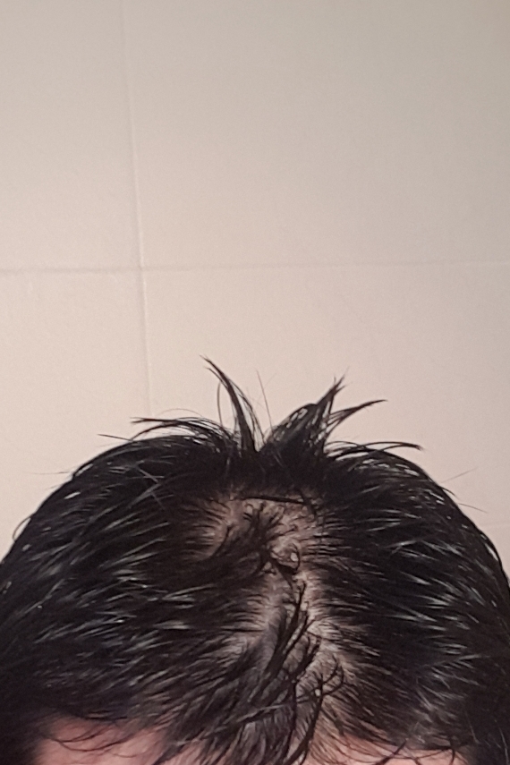 CYMERA_20180320_230826.jpg