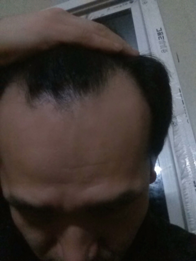 CAM00186.jpg