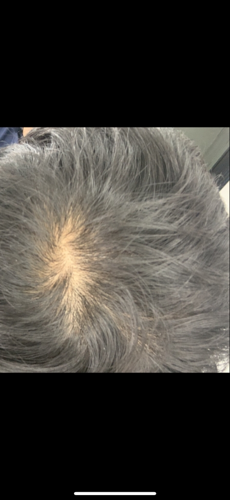3FC7FF7D-91EE-4E1F-9002-4D672092A0C2.png