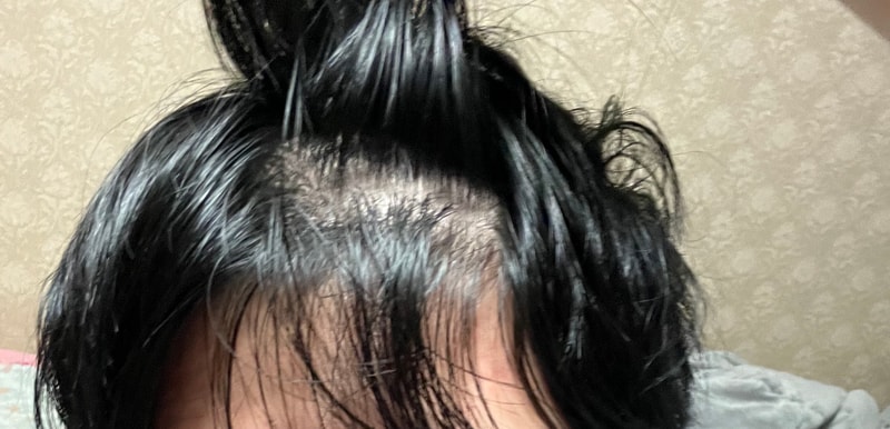 A1C1E328-DDDE-4250-9B13-639FEB778029.jpeg