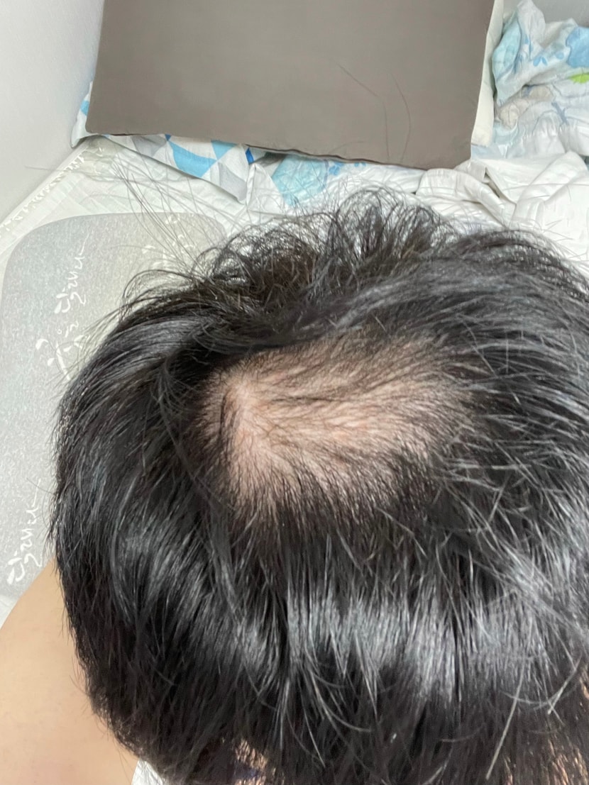사용전