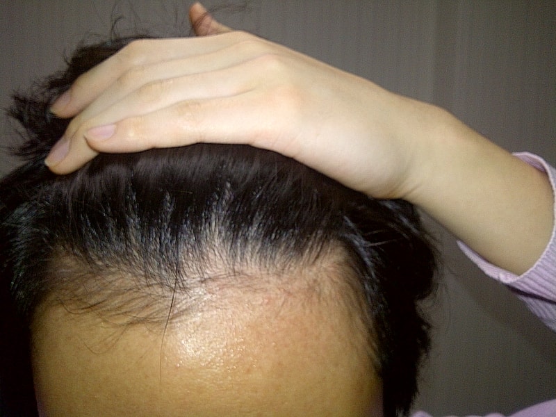 IMG-20111129-00663.jpg
