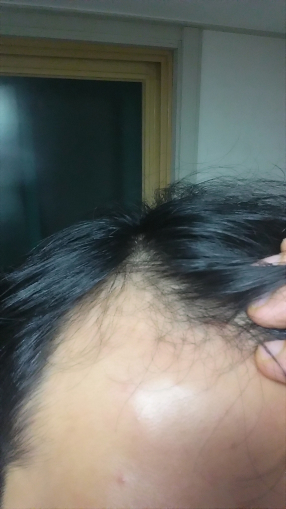 20151022_045401.jpg