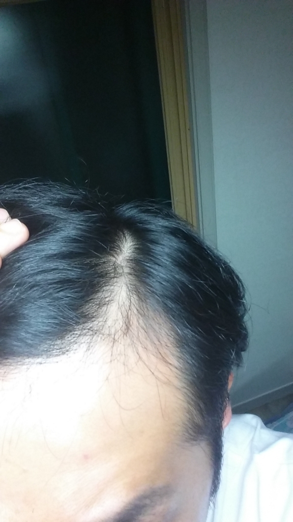 20151022_045601.jpg