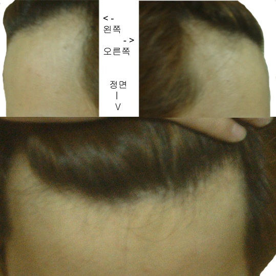 답변바람.jpg