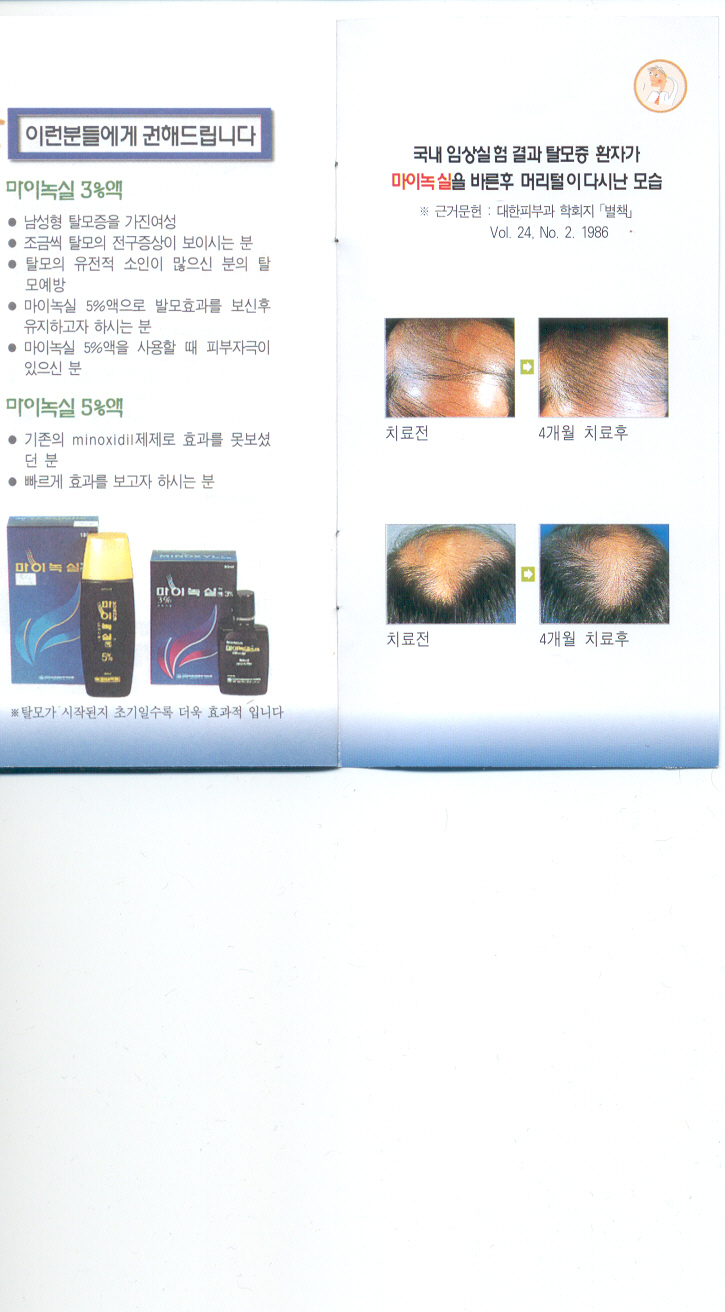 마이녹실임상실험.jpg