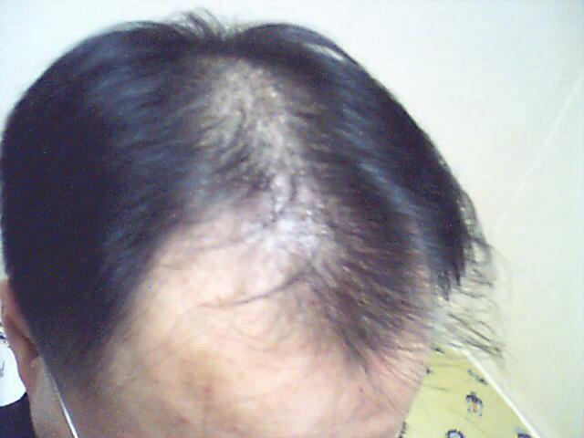 03_11_27.JPG