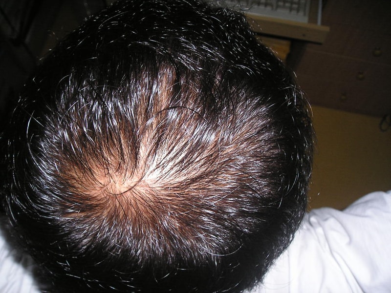 P1010100.JPG