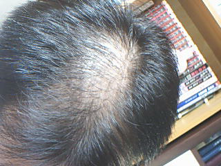 head.jpg