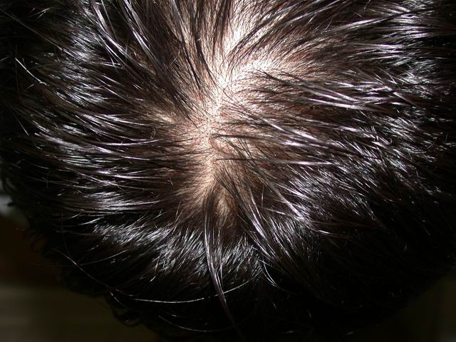 Resize_of_hair.jpg