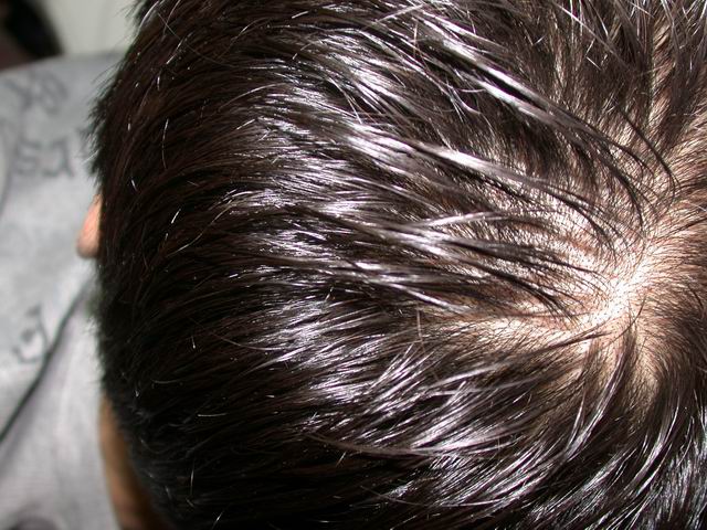 Resize_of_hair2.JPG