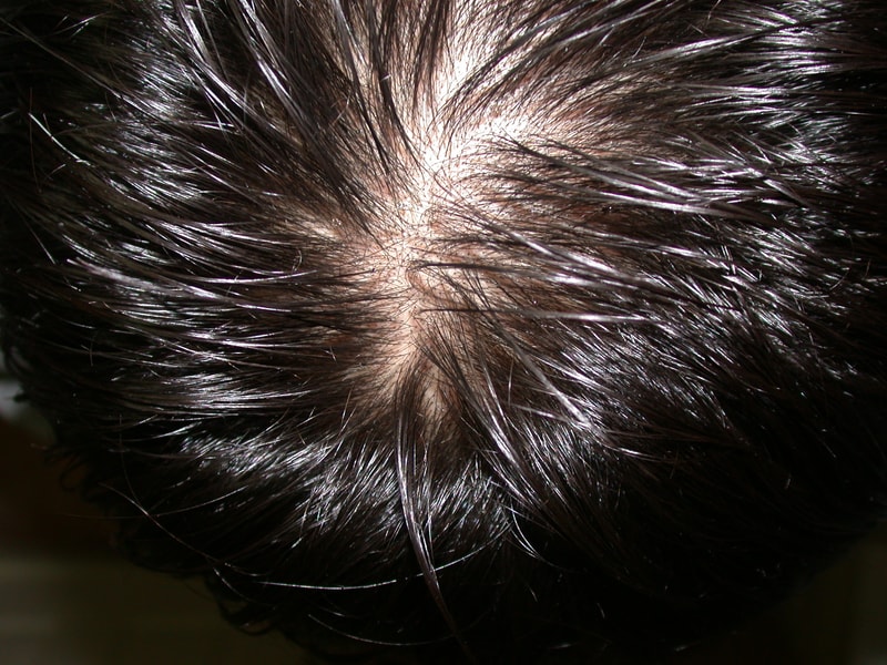 hair.jpg