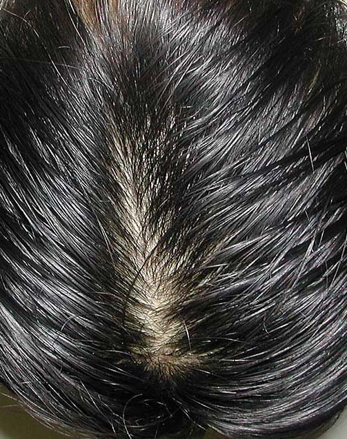 head.jpg