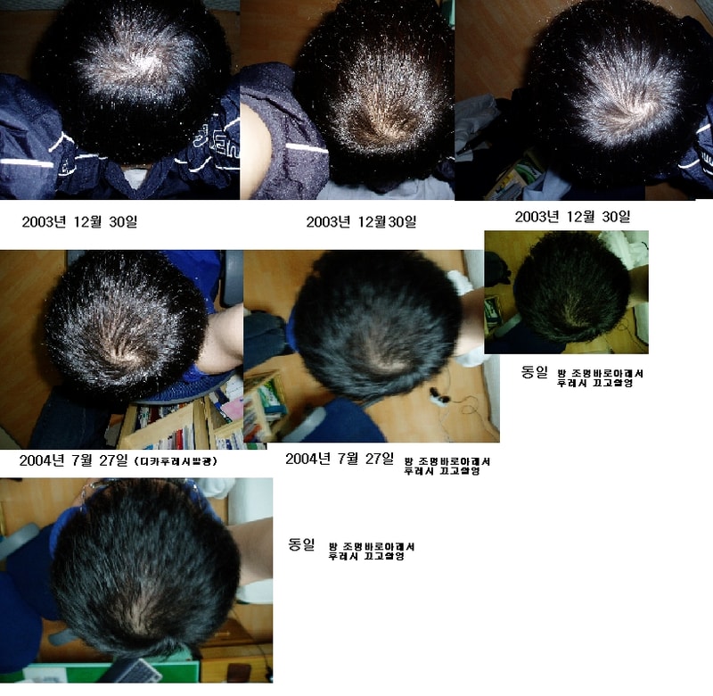 myhead.JPG