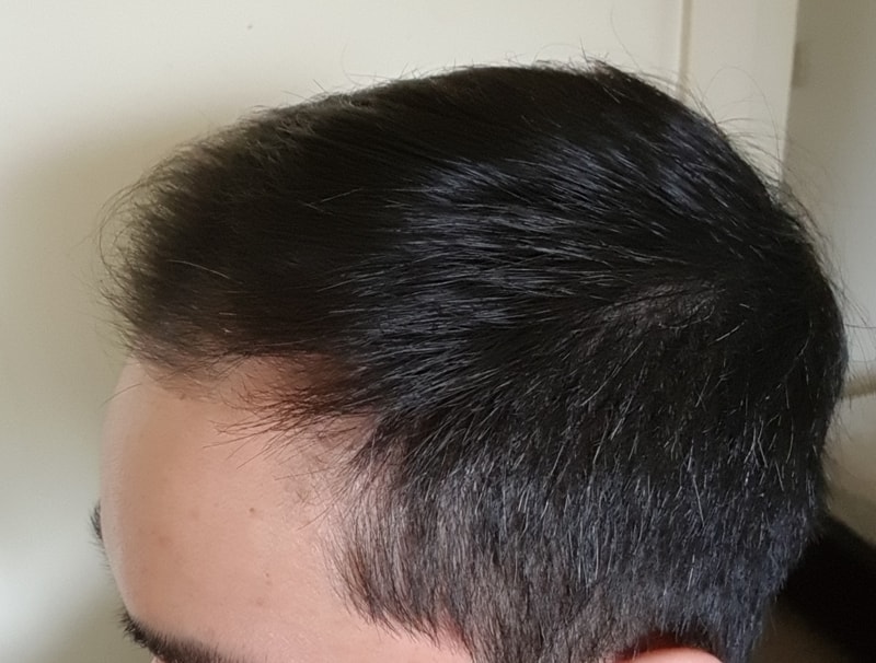 20180224_Left.jpg