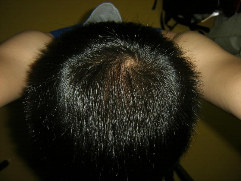프카5개월20일미녹50일.JPG