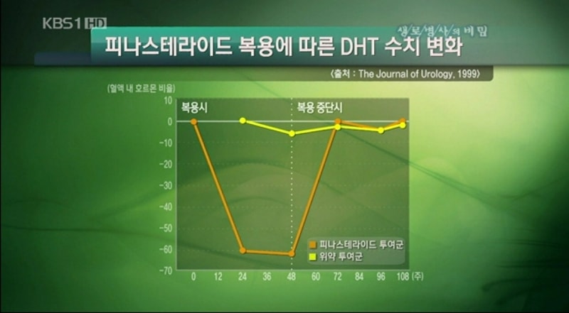 사용자 지정 1.jpg