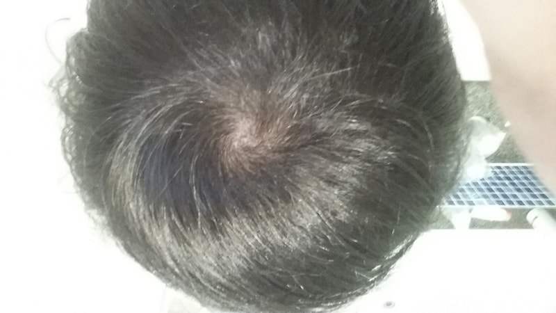 20160321_224017.jpg