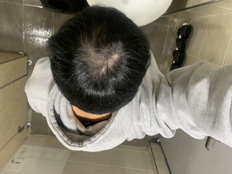 약 9개월차 