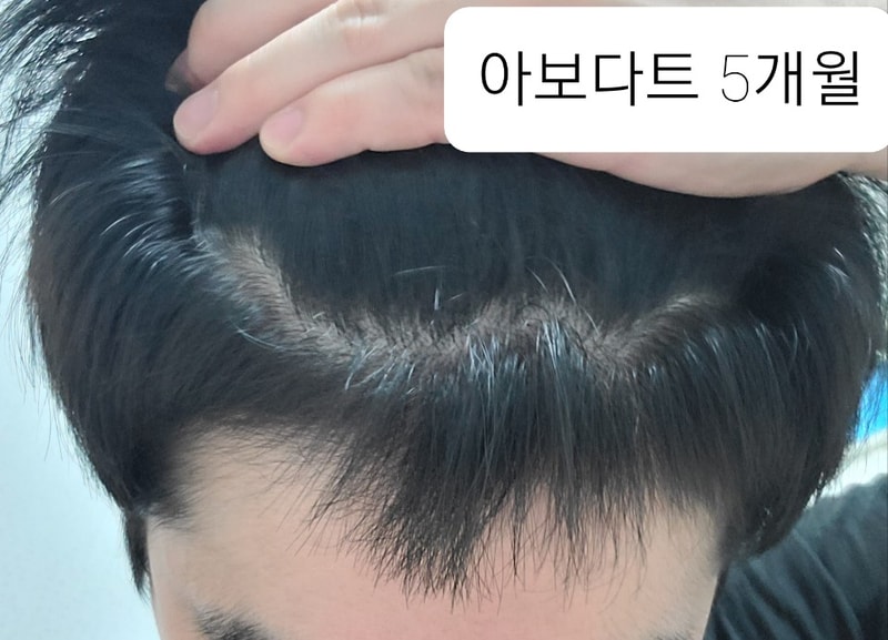 20210215_033240.jpg