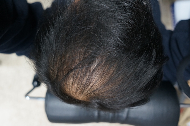2013-0316-HAIR-01.JPG