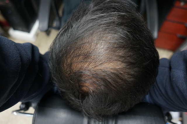 2013-0316-HAIR-04.JPG