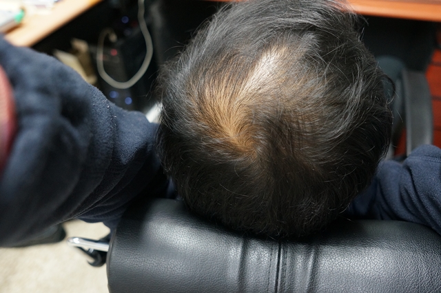2013-0316-HAIR-02.JPG