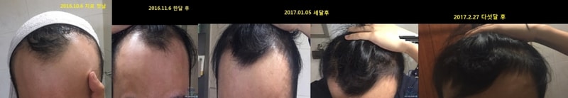 16년10월~현재.jpg