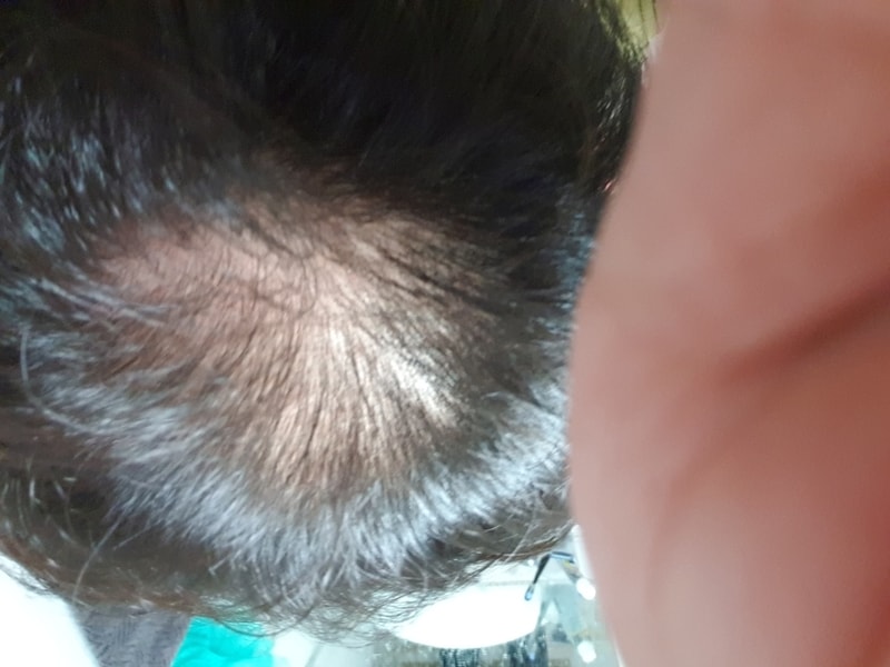 20190323_063641.jpg