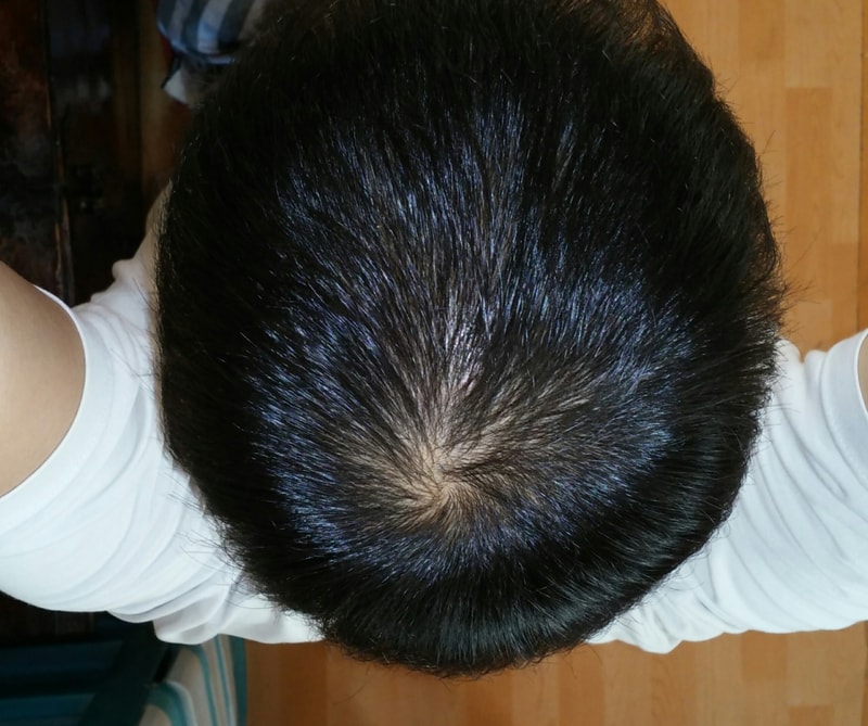 CROP_20151208_125156.JPG