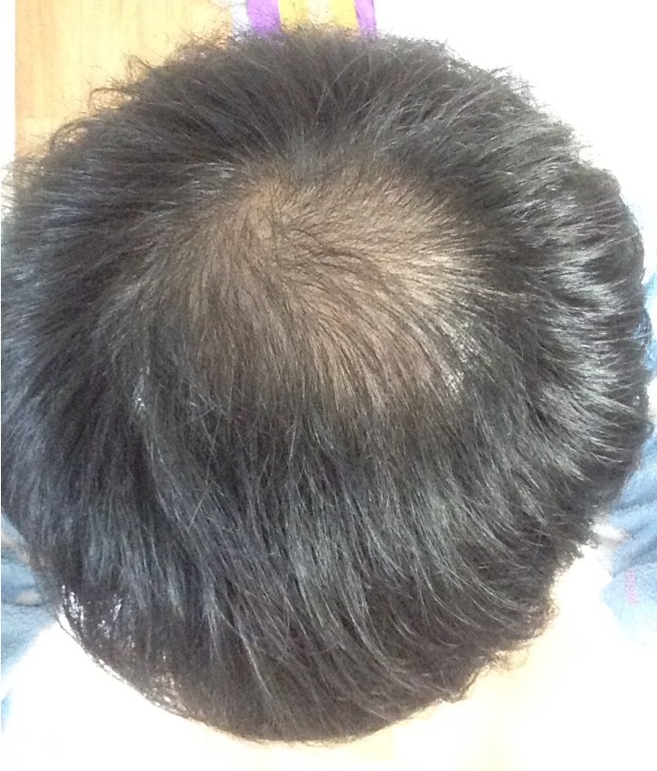 정수리2.jpg