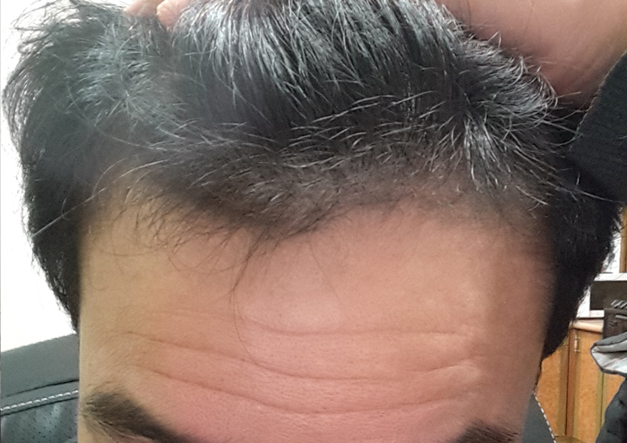20160111_front.jpg