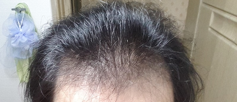 BeautyPlus_20150811235603_save.jpg
